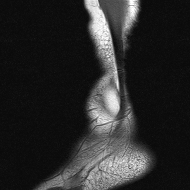 tacy  MRI  1