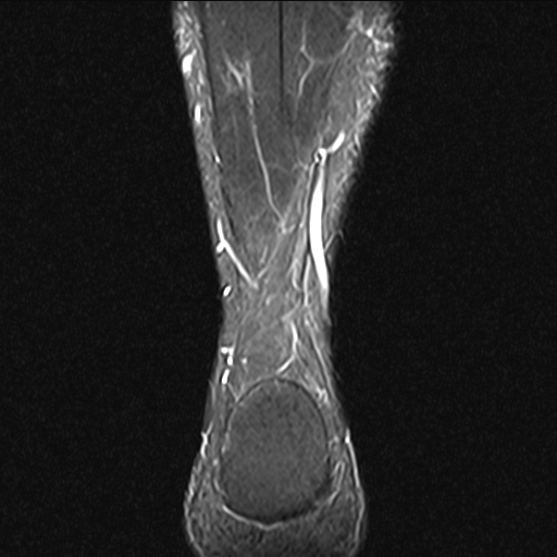 tacy  MRI  3