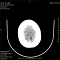 DR