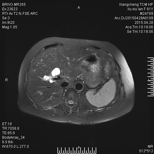 mri6636:上腹部病变