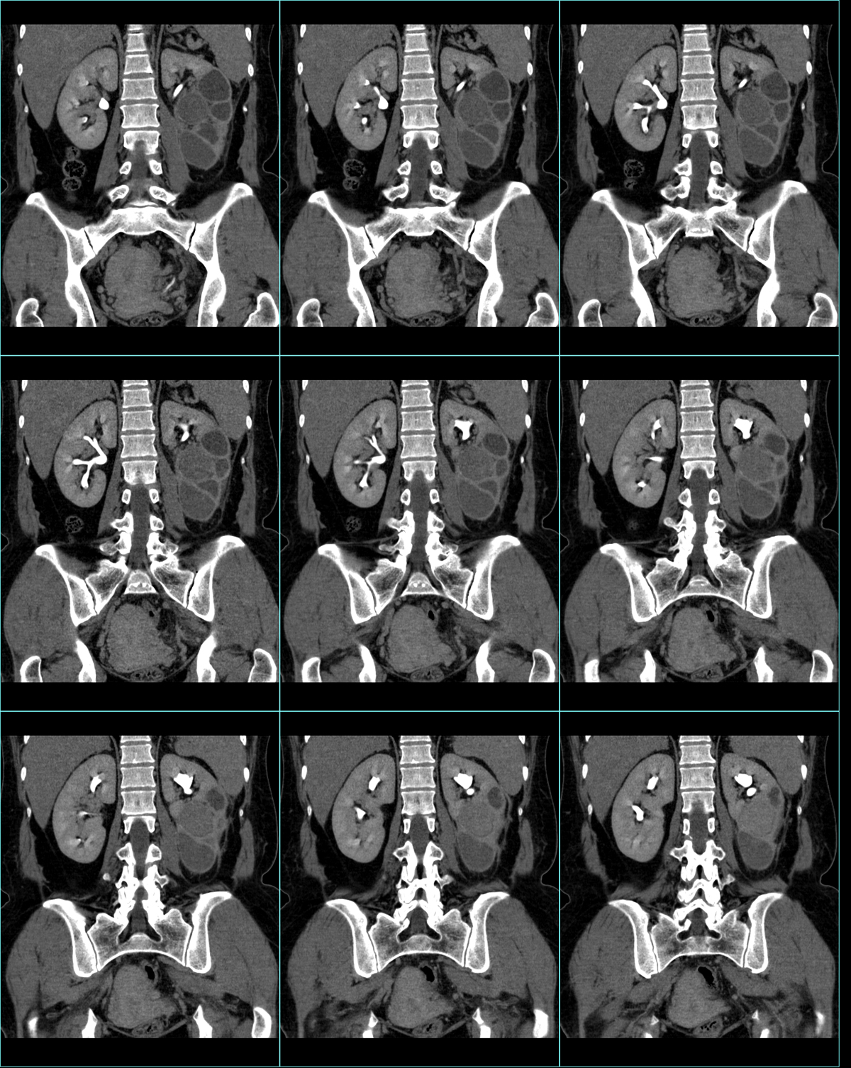 ct50439:f-54 