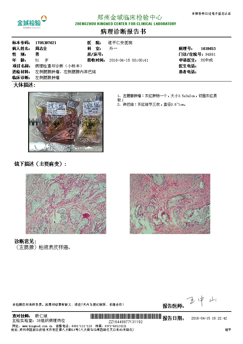 mri6961:腮腺粘液表皮样癌