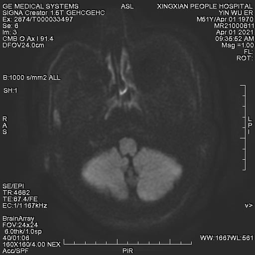 se042.jpg