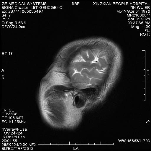 se080.jpg