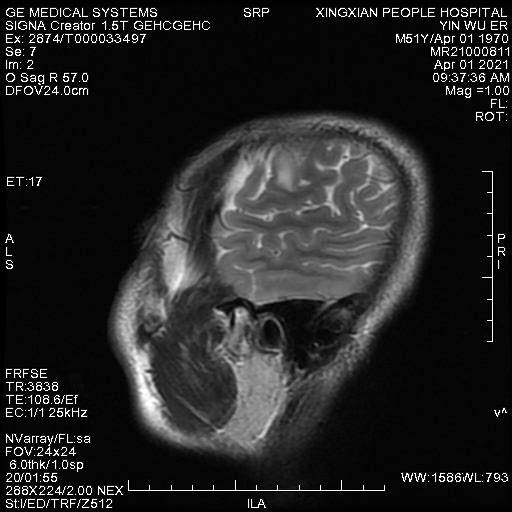 se081.jpg