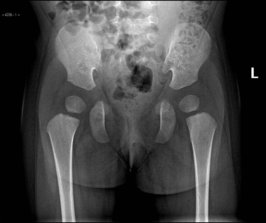 图2-PELVIC.jpg