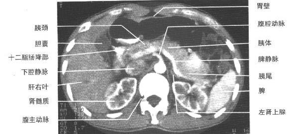 jp0135:[转帖]正常腹部ct解剖图谱