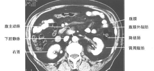 jp0135:[转帖]正常腹部ct解剖图谱