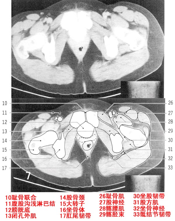 jp0169b中下腹部ct解剖续上腹部