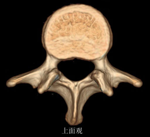 腰椎解剖-大体标本及ct三维重建
