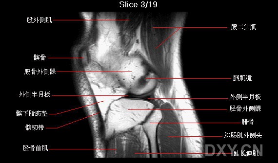 膝关节矢状位mri解剖图谱