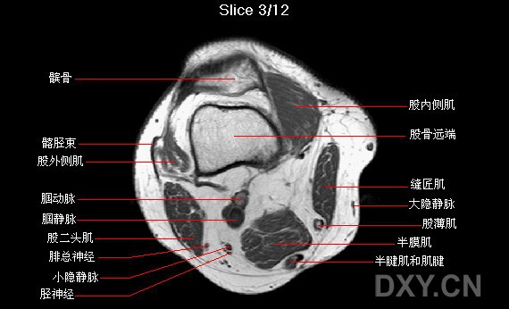 膝关节横轴位mri解剖图谱