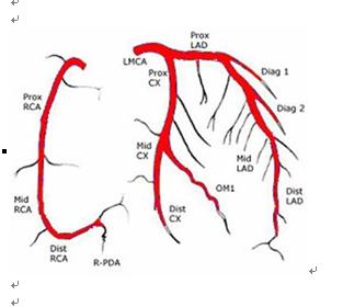 new0391:正常冠状动脉cta及x线造影