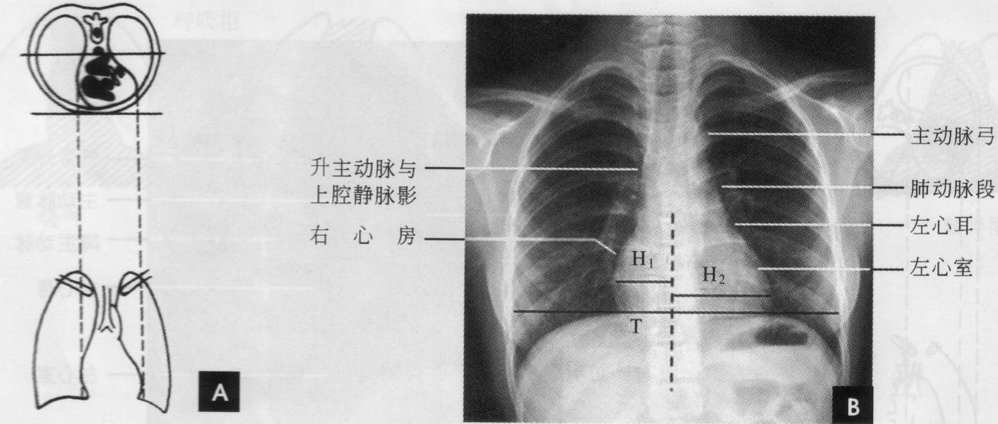 胸部x线解剖