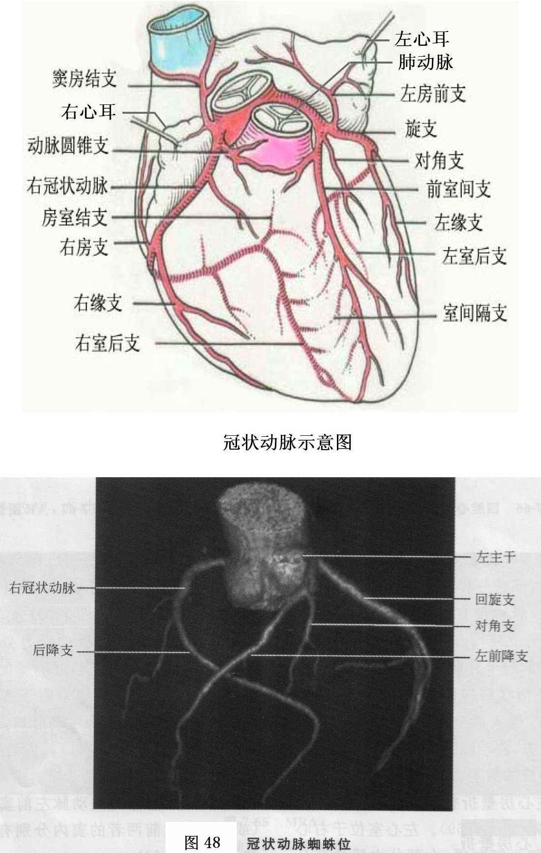 心血管ct解剖