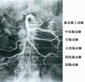 69 影像解剖 69 动脉造影x线解剖    经注入造影剂入肠系膜上动脉